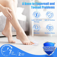 Rechargeable Nail Fungus Laser – Anti-Fungal Device Toenails, Hands & Feet (Home Use)
